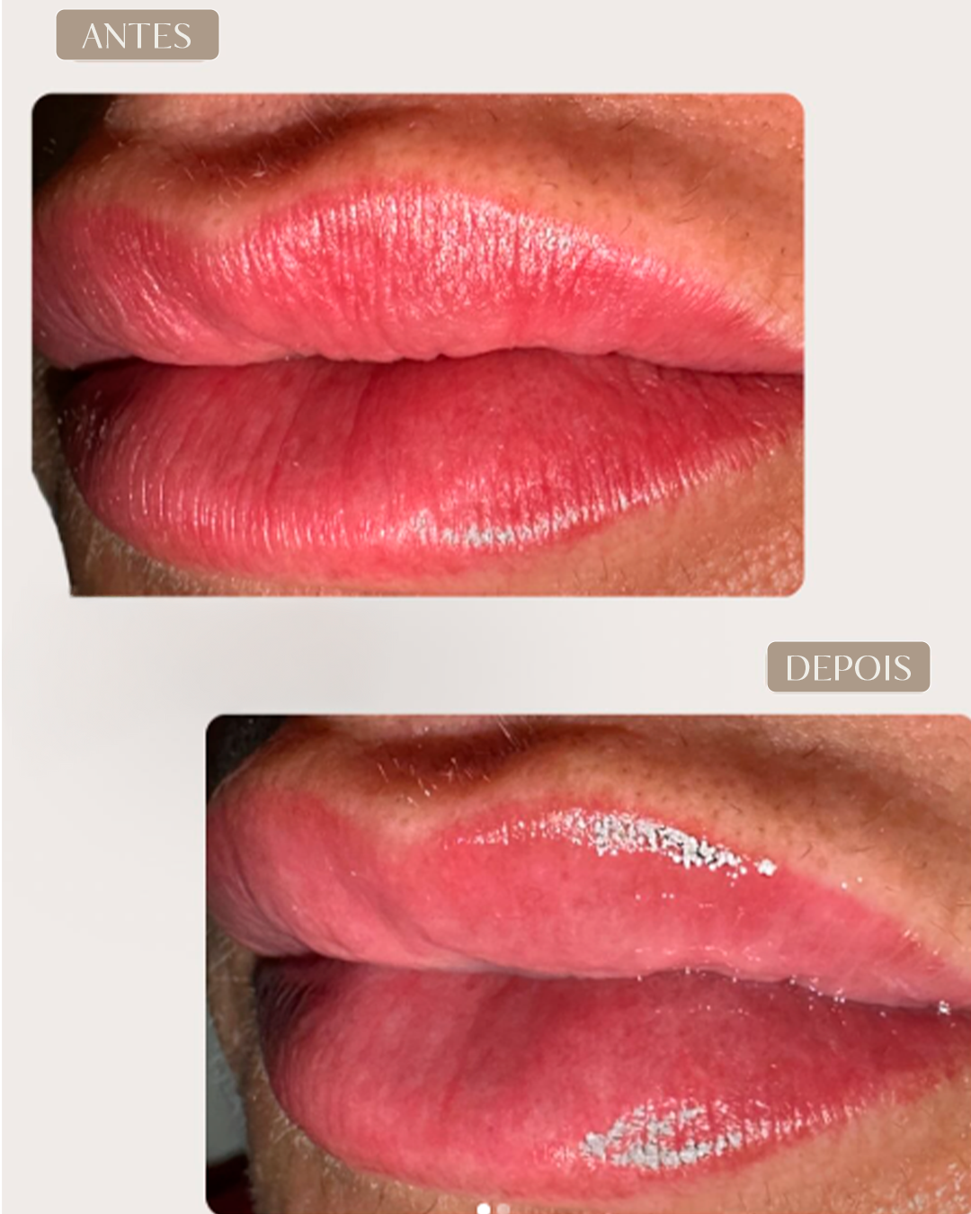 ANTES E DEPOIS 4-
