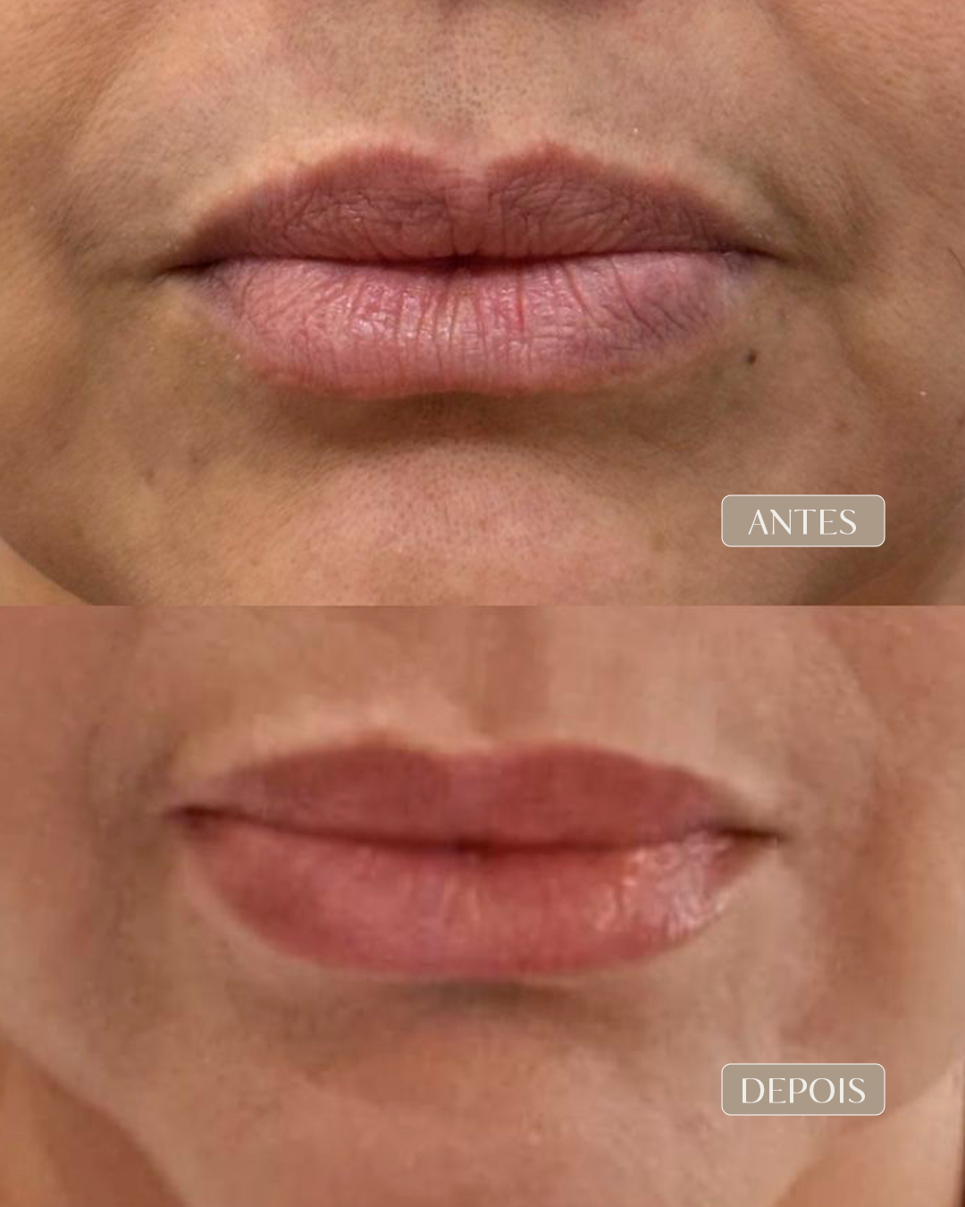 ANTES E DEPOIS 12- versão 2