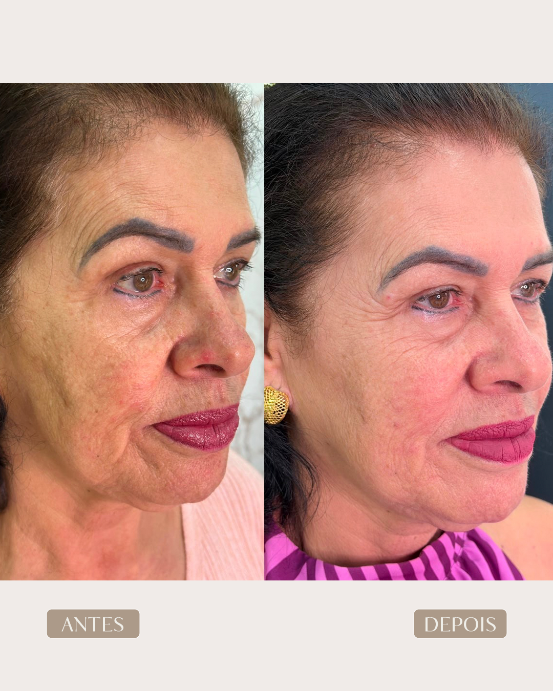 ANTES E DEPOIS 16- 2